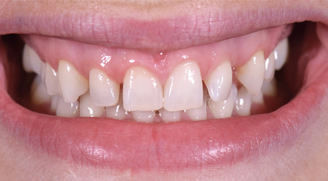 Advanced Dentistry - Before