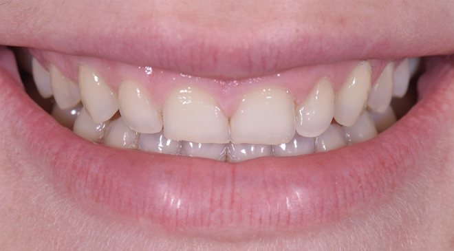 Advanced Dentistry - Before