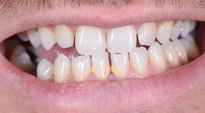 Advanced Dentistry - Before