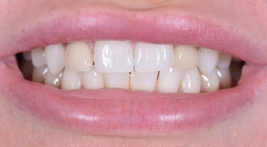 Advanced Dentistry - Before