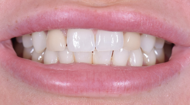 Advanced Dentistry - Before