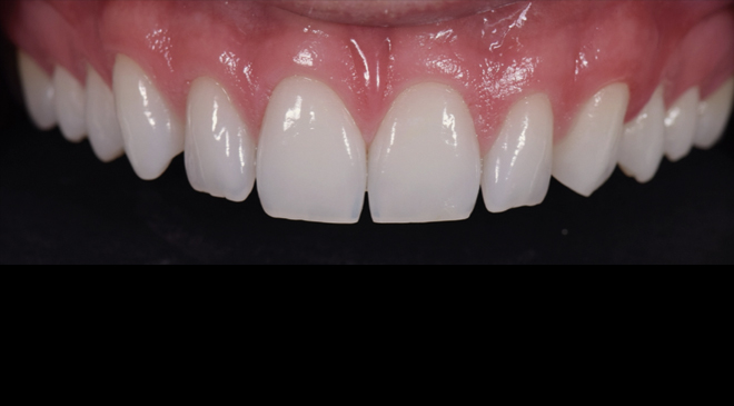 Advanced Dentistry - Before