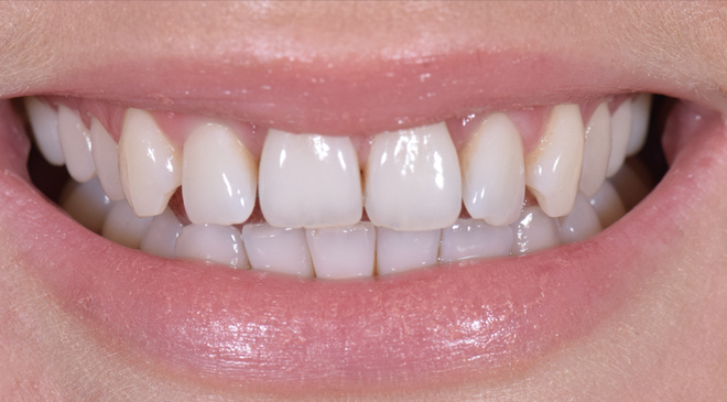 Before - Advanced Dentistry Dental Advanced Dentistry - Before