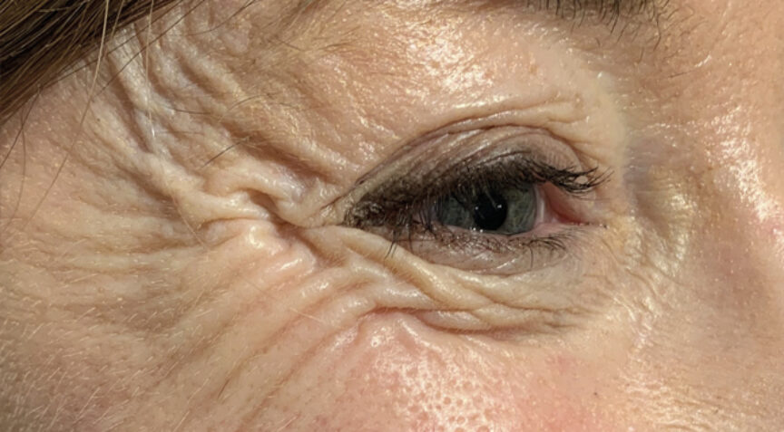 Advanced Dentistry - Before