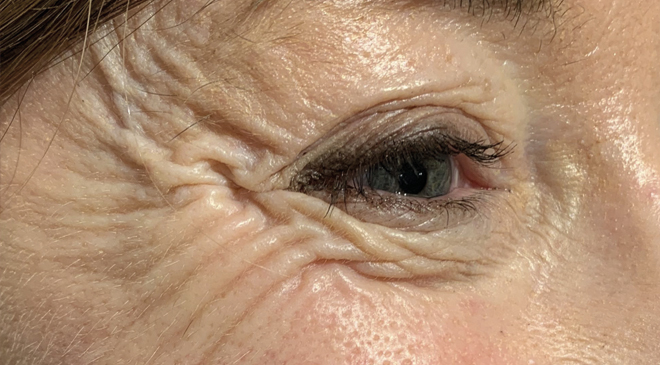 Advanced Dentistry - Before