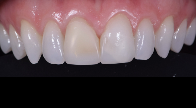 Advanced Dentistry - Before