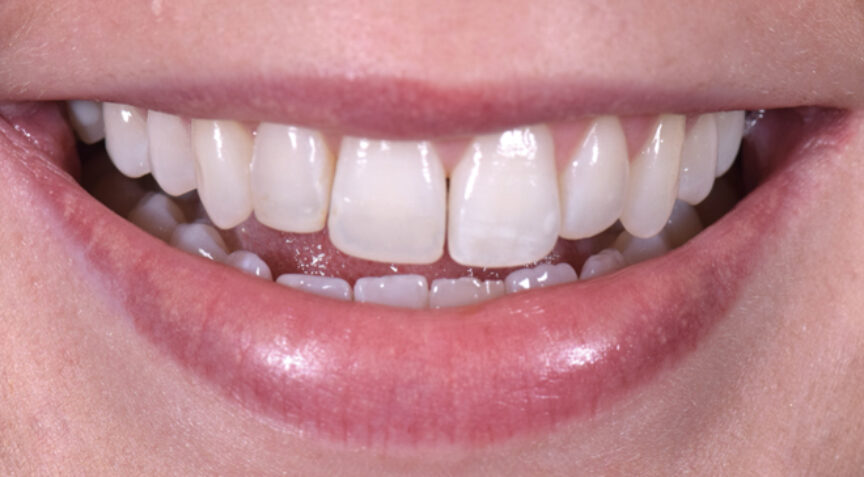 Advanced Dentistry - Before