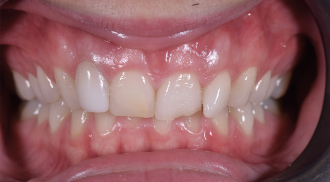 Advanced Dentistry - Before