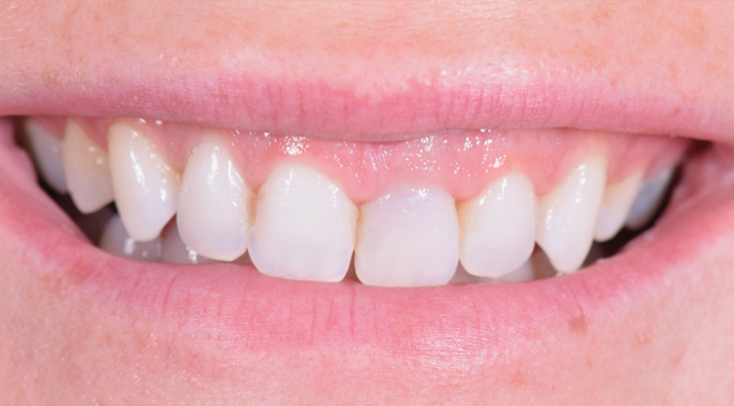 Advanced Dentistry - Before