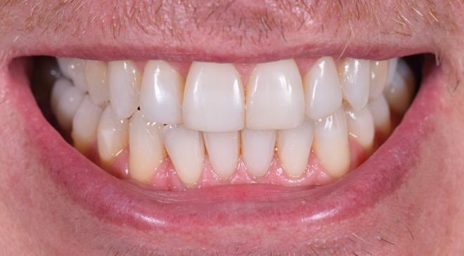 Advanced Dentistry - After