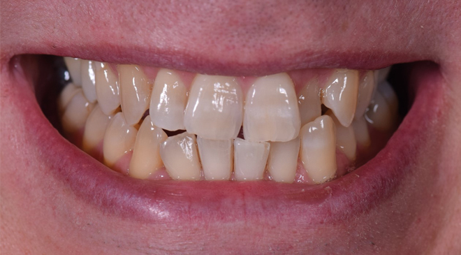 Advanced Dentistry - Before