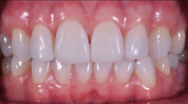 After - Advanced Dentistry Dental Advanced Dentistry - After