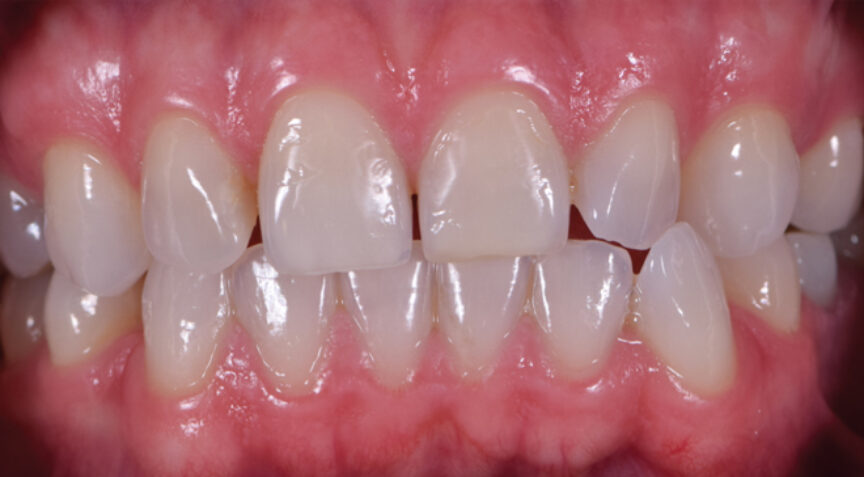 Advanced Dentistry - Before