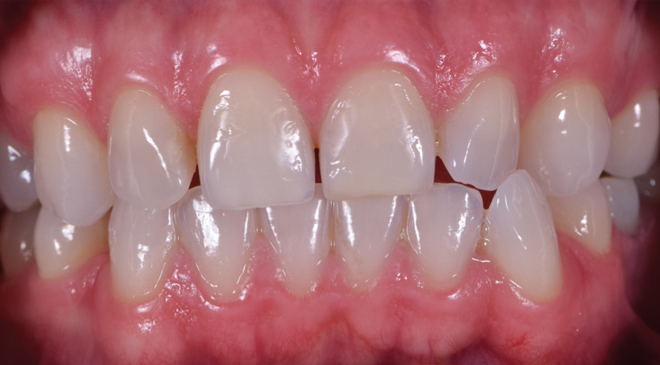 Before - Advanced Dentistry Dental Advanced Dentistry - Before