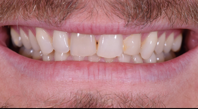 Before - Advanced Dentistry Dental Advanced Dentistry - Before