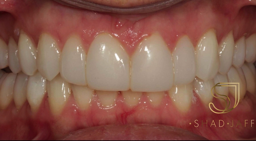 Advanced Dentistry - After