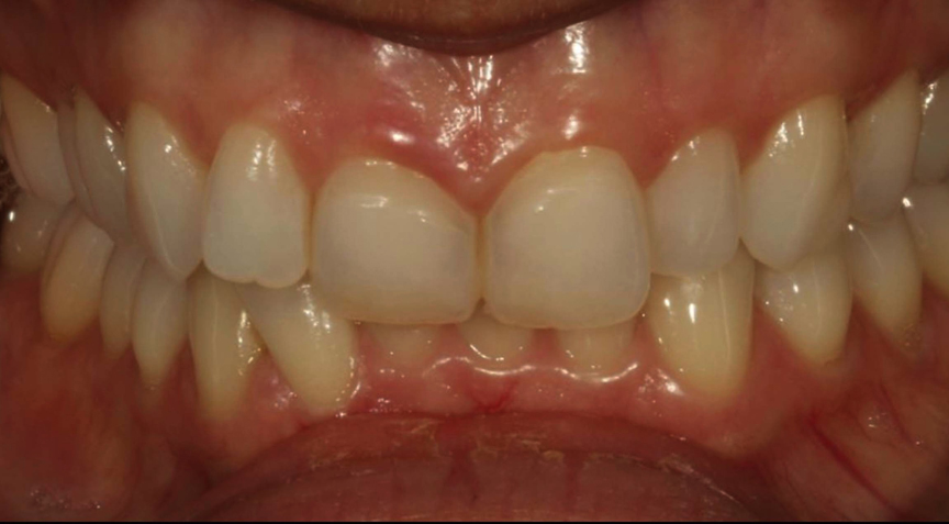 Advanced Dentistry - Before