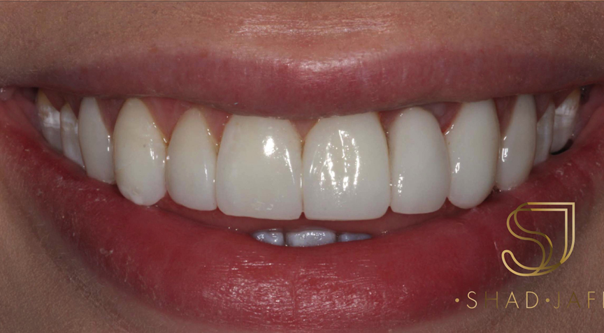 Advanced Dentistry - After