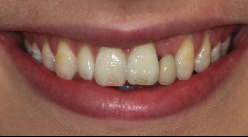 Advanced Dentistry - Before