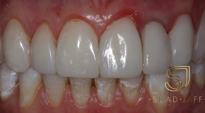 Advanced Dentistry - After