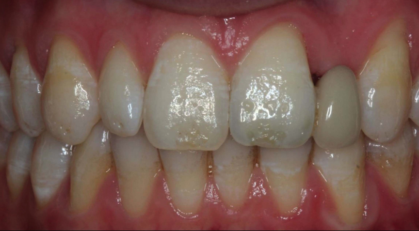 Advanced Dentistry - Before