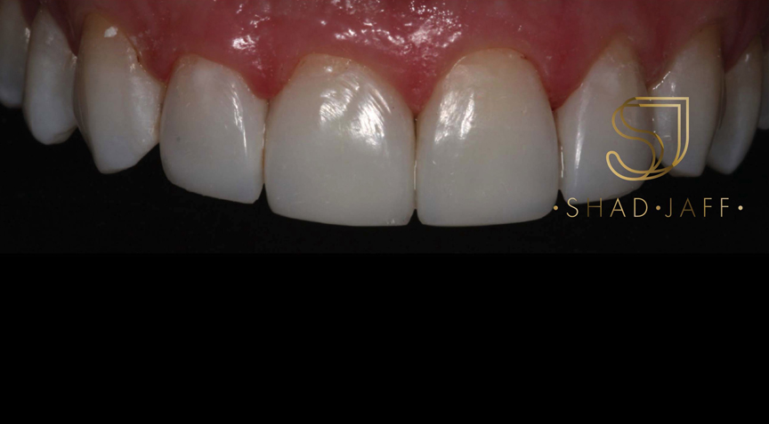 Advanced Dentistry - After