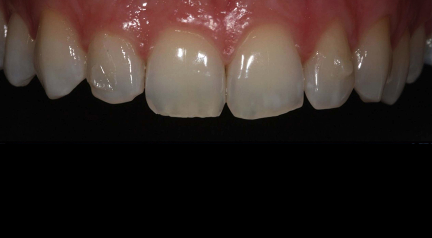 Advanced Dentistry - Before