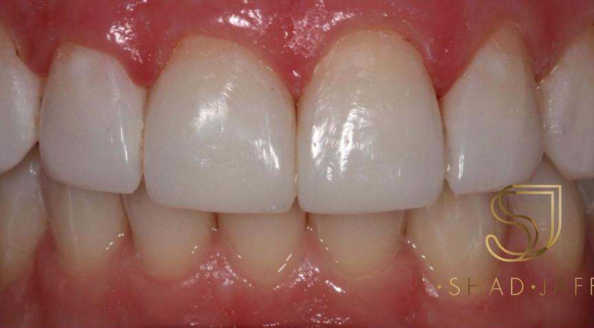 Advanced Dentistry - After