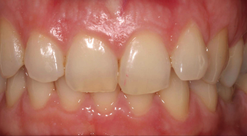 Advanced Dentistry - Before