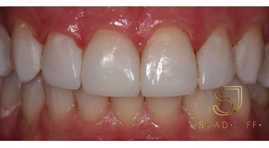 Advanced Dentistry - After