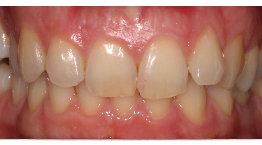 Advanced Dentistry - Before
