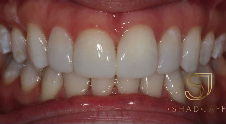 Advanced Dentistry - After