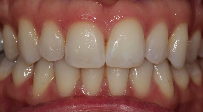 Advanced Dentistry - Before
